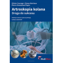 Artroskopia kolana droga do sukcesu