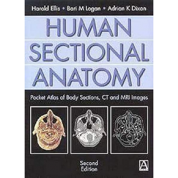Human Sectional Anatomy. Atlas of Body Sections, CT and MRI Images