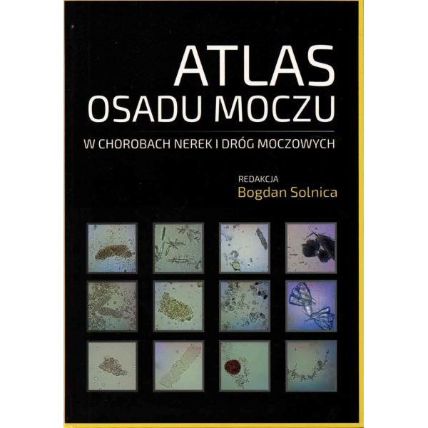 Atlas osadu moczu w...