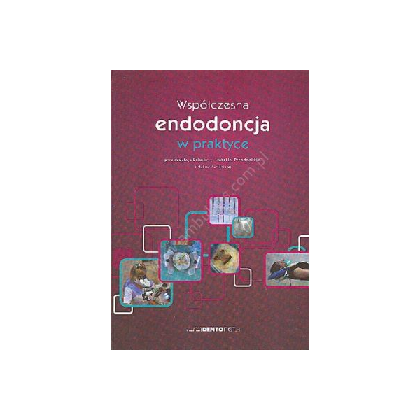 Współczesna endodoncja w praktyce