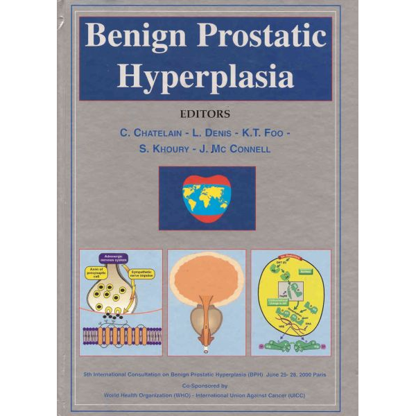Benign Prostatic Hyperplasia