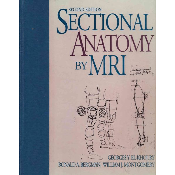 Sectional Anatomy by MRI