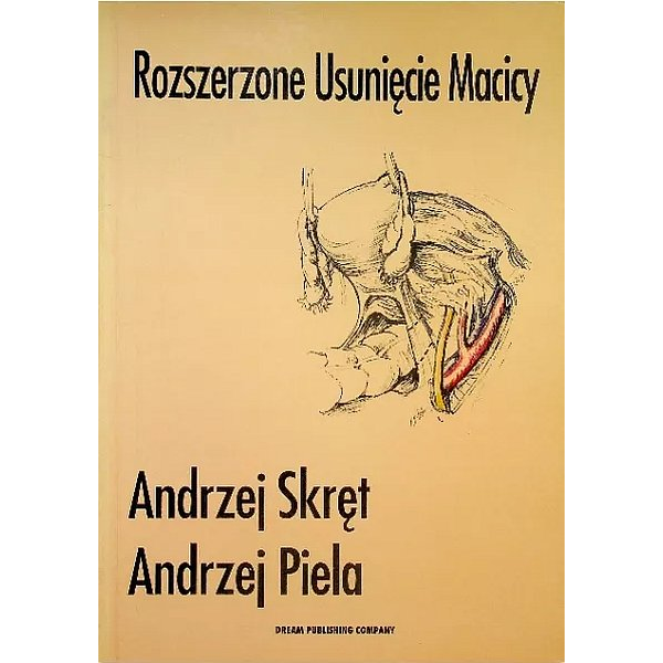 Rozszerzone usunięcie macicy