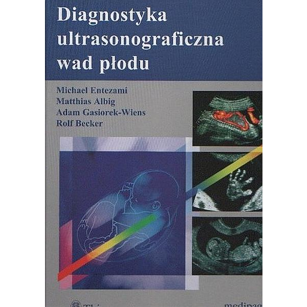 Diagnostyka ultrasonograficzna wad płodu Diagnostyka ultrasonograficzna wad płodu