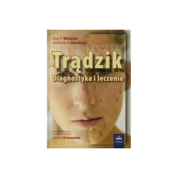 Trądzik Diagnostyka i leczenie
