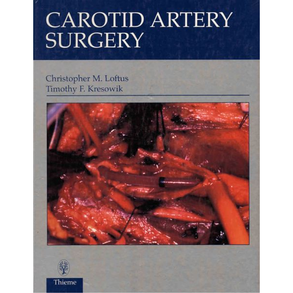 Carotid Artery Surgery
