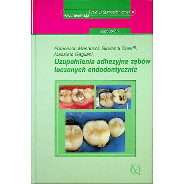 Uzupełnienia adhezyjne...