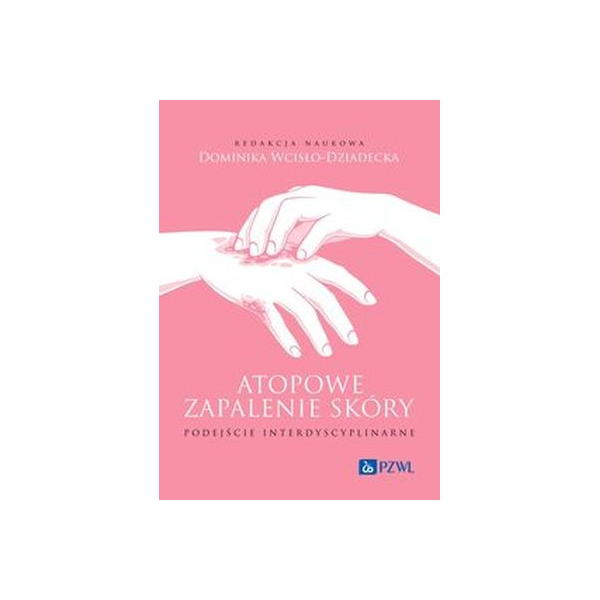 Atopowe zapalenie skóry podejście interdyscyplinarne Atopowe zapalenie skóry podejście interdyscyplinarne