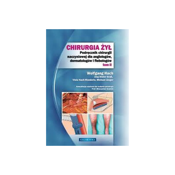 Chirurgia żył podręcznui dla chirurgów ogólnych, chirurgów naczyniowych,angiologów, dermatologów i flebologów Chirurgia żył podręcznui dla chirurgów ogólnych, chirurgów naczyniowych,angiologów, dermatologów i flebologów