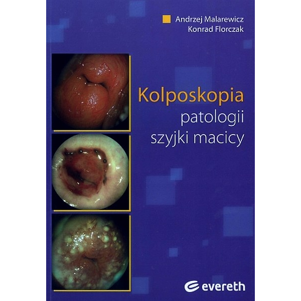 Kolposkopia patologii szyjki macicy 