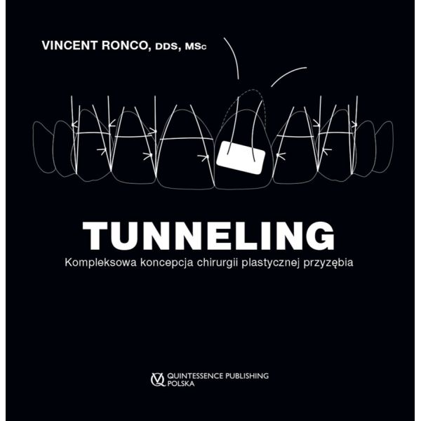 Tunneling Kompleksowa...