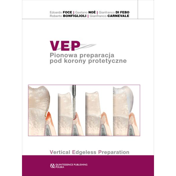 VEP Pionowa preparacja pod...