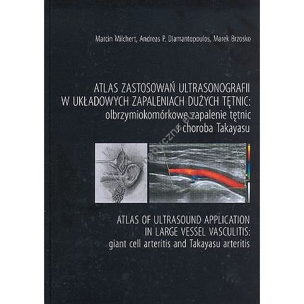 Atlas zastosowań ultrasinografii w układowych zapaleniach dużych tętnic