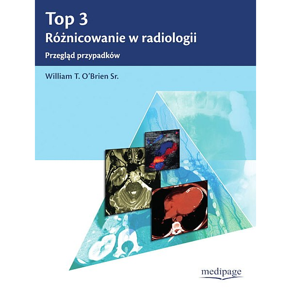 Top 3 Różnicowanie w radiologii. Przegląd przypadków