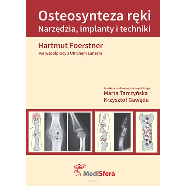 Osteosynteza ręki...