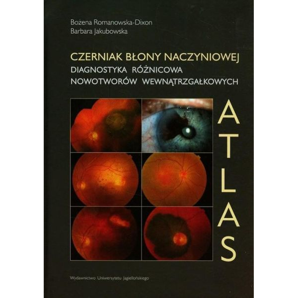 Czerniak błony naczyniowej...