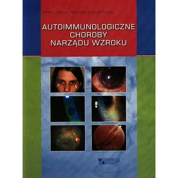 Autoimmunologiczne choroby narządu wzroku