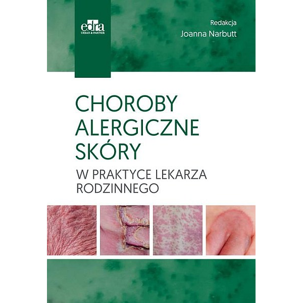 Choroby alergiczne skóryw poaktyce lekarza rodzinnego Choroby alergiczne skóryw poaktyce lekarza rodzinnego