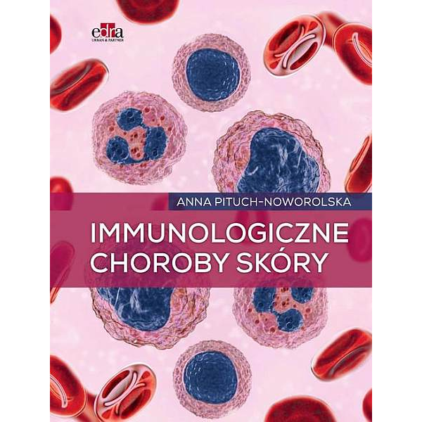 Immunologiczne choroby skóry Immunologiczne choroby skóry