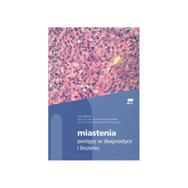Miastenia Postępy w diagnostyce i w leczeniu Miastenia Postępy w diagnostyce i w leczeniu