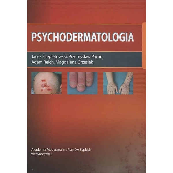 Psychodermatologia