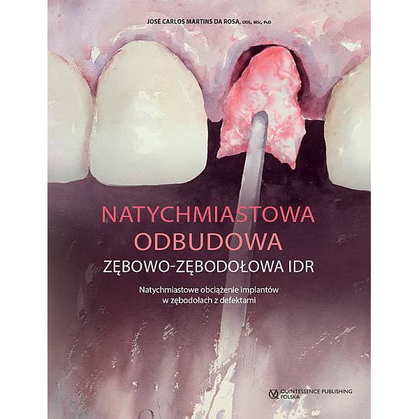 Natychmiastowa odbudowa...