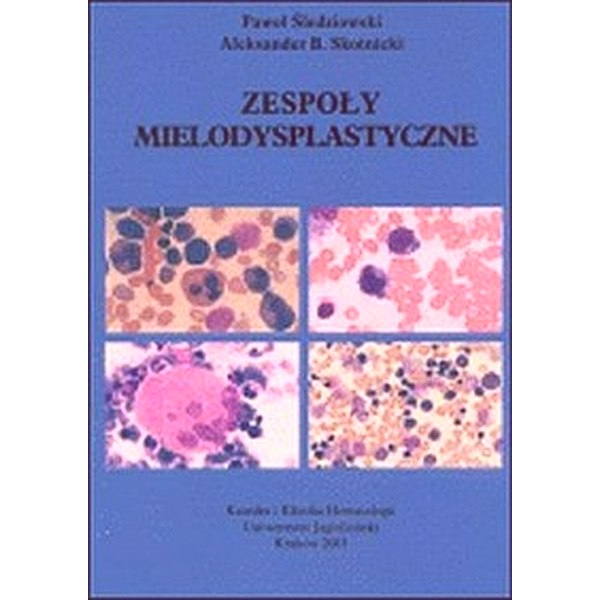 Zespoły mielodysplastyczne