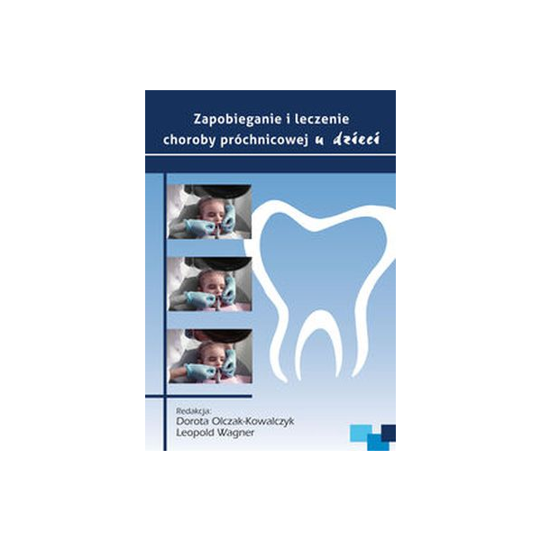 Zapobieganie i leczenie choroby próchnicowej u dzieci