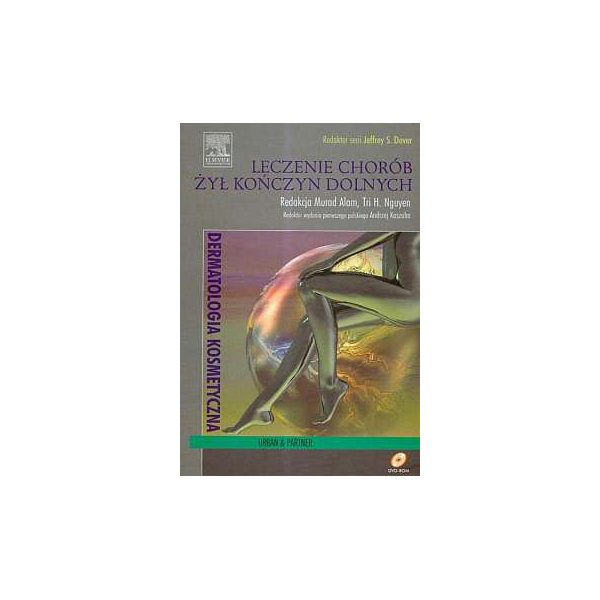Leczenie chorób żył kończyn dolnych (z DVD)