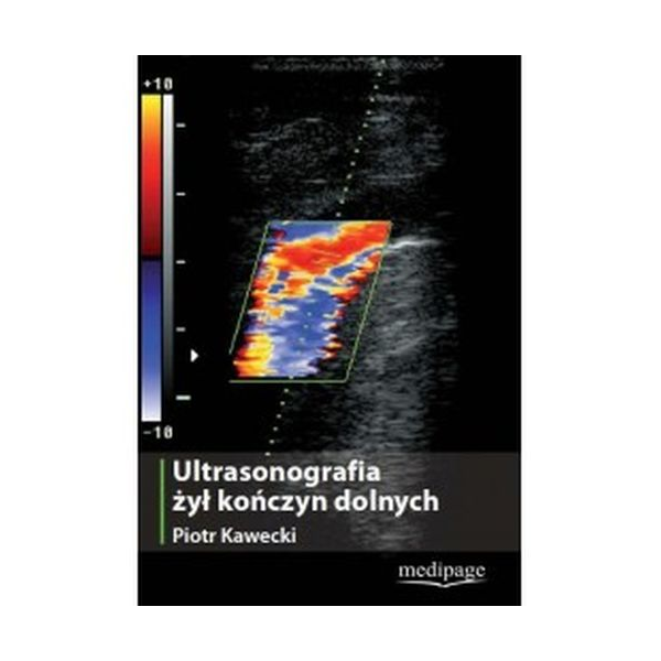 USG żył kończyn dolnych