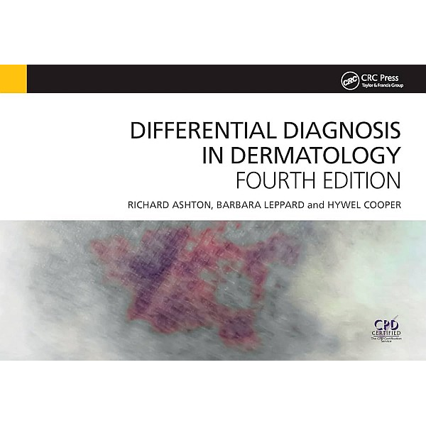 Differential Diagnosis in...