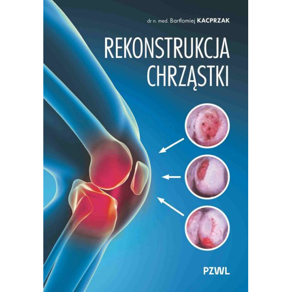 Rekonstrukcja chrząstki...