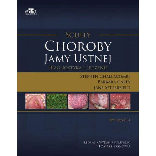 Choroby jamy ustnej...