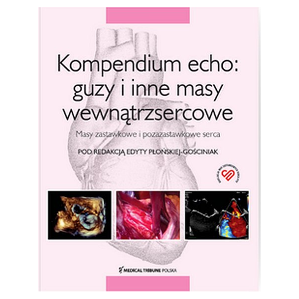 Kompendium echo: guzy i inne masy wewnątrzsercowe