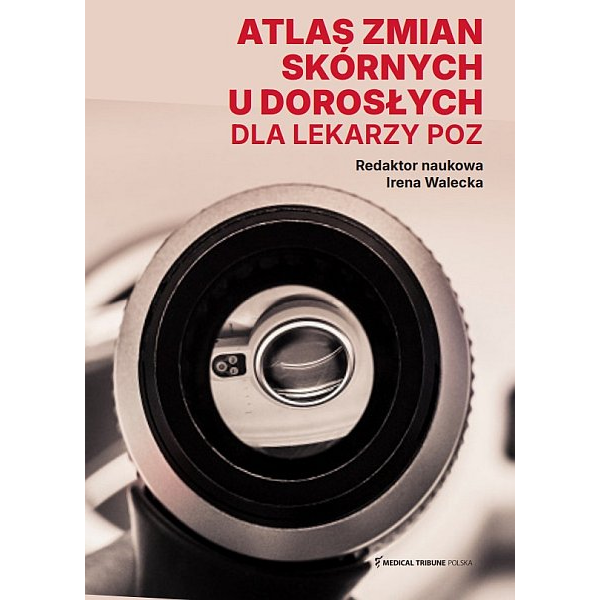 Atlas zmian skórnych u dorosłych dla lekarzy POZ