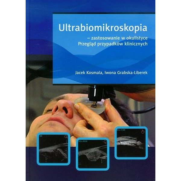 Ultrabiomikroskopia-zastosowanie w okulistyce Przegląd przypadków klinicznych