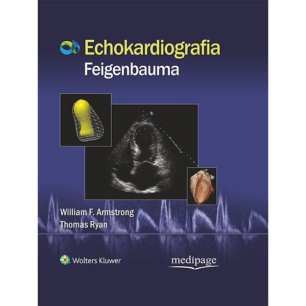 ECHOKARDIOGRAFIA FEIGENBAUMA
