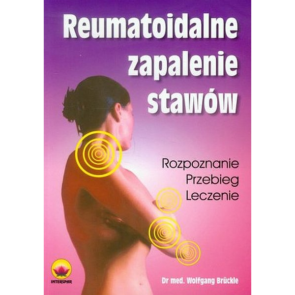 Reumatoidalne zapalenia stawów