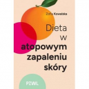 Dieta w atopowym zapaleniu skóry