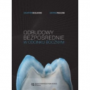 Odbudowy bezpośrednie w odcinku bocznym