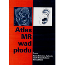 Atlas MR wad płodu