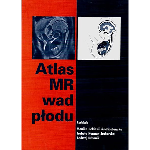 Atlas MR wad płodu