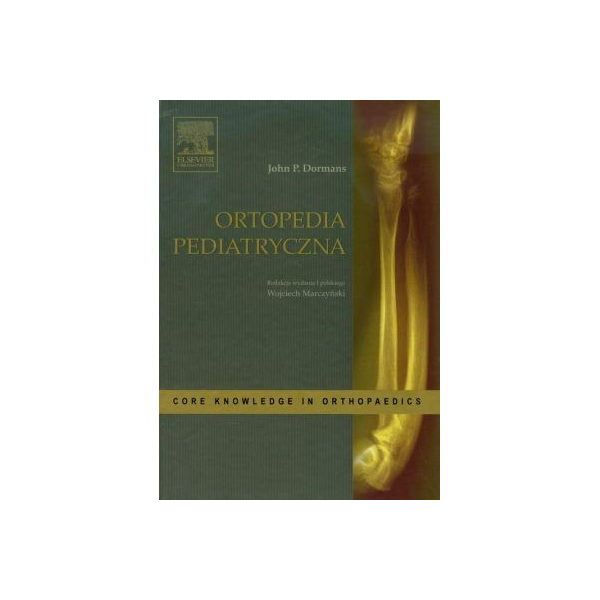 Ortopedia pediatryczna