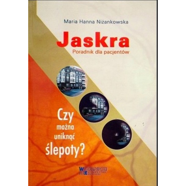 Jaskra Poradnik dla pacjentów