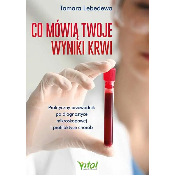 Co mówią twoje wyniki krwi, praktyczny przewodnik po diagnostyce mikroskopowej i profilaktyce chorób