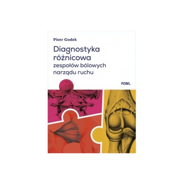 Diagnostyka różnicowa zespołów bólowych narządu ruchu