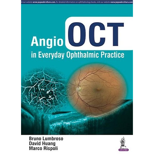Angio OCT w codziennej praktyce okulistycznej