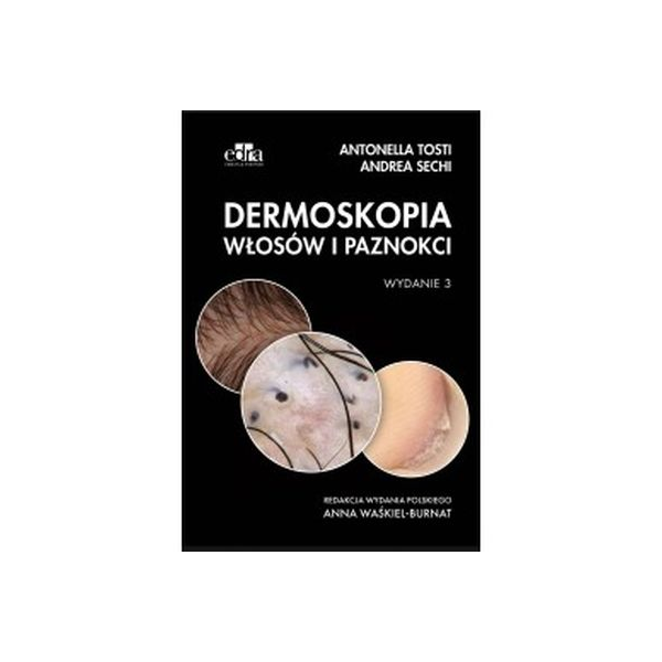 Dermoskopia włosów i paznokci wyd.3