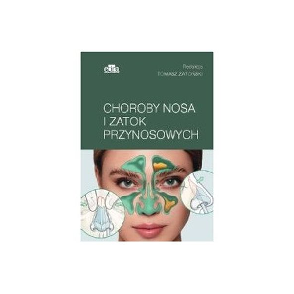 Choroby nosa i zatok przynosowych 