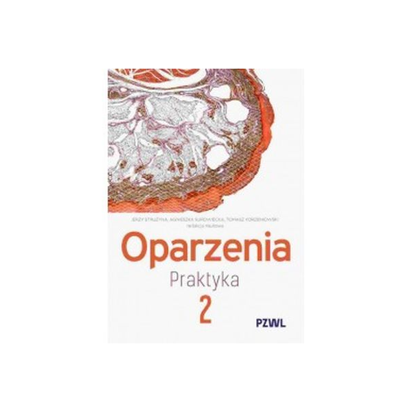 Oparzenia t.2 Praktyka